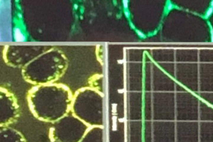 CIB researchers mastering FLIM to target breast cancer