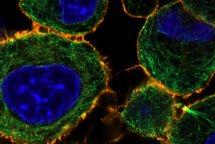 Collaboration between CIB and ZEISS continues