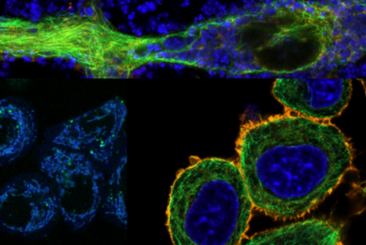ZEISS and CIB organized workshop in advanced imaging